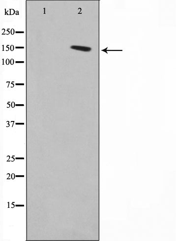 AF0638 staining HuvEc by IF/ICC. The sample were fixed with PFA and permeabilized in 0.1% Triton X-100,then blocked in 10% serum for 45 minutes at 25¡ãC. The primary antibody was diluted at 1/200 and incubated with the sample for 1 hour at 37¡ãC. An  Alexa Fluor 594 conjugated goat anti-rabbit IgG (H+L) Ab, diluted at 1/600, was used as the secondary antibod