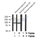 Western blot analysis IR (Phospho-Tyr999) using Etoposide treated 293 whole cell lysates