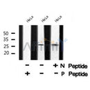 Western blot analysis of extracts from rat brain, using p27 Kip1 (Phospho-Thr157) Antibody. Lane 1 was treated with the blocking peptide.