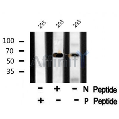 AF8058 staining HeLa by IF/ICC. The sample were fixed with PFA and permeabilized in 0.1% Triton X-100,then blocked in 10% serum for 45 minutes at 25¡ãC. The primary antibody was diluted at 1/200 and incubated with the sample for 1 hour at 37¡ãC. An  Alexa Fluor 594 conjugated goat anti-rabbit IgG (H+L) Ab, diluted at 1/600, was used as the secondary antibod