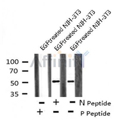 AF8122 staining MDA-MB-435 by IF/ICC. The sample were fixed with PFA and permeabilized in 0.1% Triton X-100,then blocked in 10% serum for 45 minutes at 25¡ãC. The primary antibody was diluted at 1/200 and incubated with the sample for 1 hour at 37¡ãC. An  Alexa Fluor 594 conjugated goat anti-rabbit IgG (H+L) Ab, diluted at 1/600, was used as the secondary antibod
