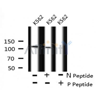 AF8125 staining MOLT by IF/ICC. The sample were fixed with PFA and permeabilized in 0.1% Triton X-100,then blocked in 10% serum for 45 minutes at 25¡ãC. The primary antibody was diluted at 1/200 and incubated with the sample for 1 hour at 37¡ãC. An  Alexa Fluor 594 conjugated goat anti-rabbit IgG (H+L) Ab, diluted at 1/600, was used as the secondary antibod