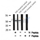 AF8169 staining HeLa by IF/ICC. The sample were fixed with PFA and permeabilized in 0.1% Triton X-100,then blocked in 10% serum for 45 minutes at 25¡ãC. The primary antibody was diluted at 1/200 and incubated with the sample for 1 hour at 37¡ãC. An  Alexa Fluor 594 conjugated goat anti-rabbit IgG (H+L) Ab, diluted at 1/600, was used as the secondary antibod