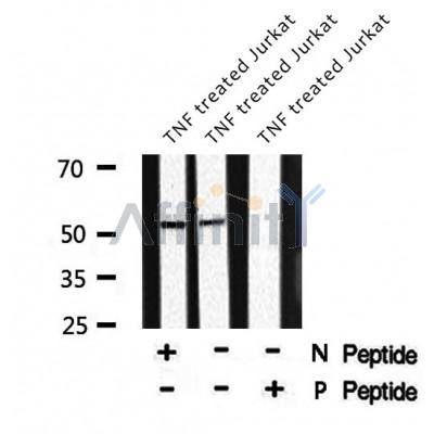 AF8169 staining HeLa by IF/ICC. The sample were fixed with PFA and permeabilized in 0.1% Triton X-100,then blocked in 10% serum for 45 minutes at 25¡ãC. The primary antibody was diluted at 1/200 and incubated with the sample for 1 hour at 37¡ãC. An  Alexa Fluor 594 conjugated goat anti-rabbit IgG (H+L) Ab, diluted at 1/600, was used as the secondary antibod