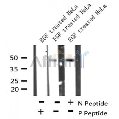 AF8176 at 1/200 staining Human kidney tissue sections by IHC-P. The tissue was formaldehyde fixed and a heat mediated antigen retrieval step in citrate buffer was performed. The tissue was then blocked and incubated with the antibody for 1.5 hours at 22¡ãC. An HRP conjugated goat anti-rabbit antibody was used as the secondary