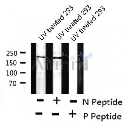 Western blot analysis of extracts from mouse brain and 293, using BRCA1 (Phospho-Ser1497) Antibody.