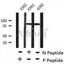 AF8211 at 1/200 staining Rat ganstric tissue sections by IHC-P. The tissue was formaldehyde fixed and a heat mediated antigen retrieval step in citrate buffer was performed. The tissue was then blocked and incubated with the antibody for 1.5 hours at 22¡ãC. An HRP conjugated goat anti-rabbit antibody was used as the secondary