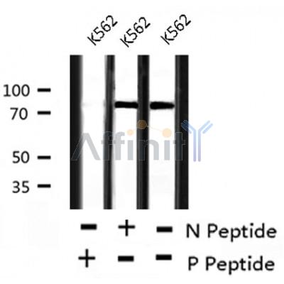 AF8211 at 1/200 staining Rat ganstric tissue sections by IHC-P. The tissue was formaldehyde fixed and a heat mediated antigen retrieval step in citrate buffer was performed. The tissue was then blocked and incubated with the antibody for 1.5 hours at 22¡ãC. An HRP conjugated goat anti-rabbit antibody was used as the secondary