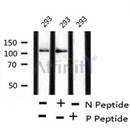 AF8222 at 1/200 staining Rat lung tissue sections by IHC-P. The tissue was formaldehyde fixed and a heat mediated antigen retrieval step in citrate buffer was performed. The tissue was then blocked and incubated with the antibody for 1.5 hours at 22¡ãC. An HRP conjugated goat anti-rabbit antibody was used as the secondary