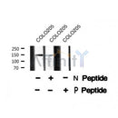 AF8255 at 1/200 staining Rat lung tissue sections by IHC-P. The tissue was formaldehyde fixed and a heat mediated antigen retrieval step in citrate buffer was performed. The tissue was then blocked and incubated with the antibody for 1.5 hours at 22¡ãC. An HRP conjugated goat anti-rabbit antibody was used as the secondary