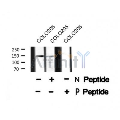 AF8255 at 1/200 staining Rat lung tissue sections by IHC-P. The tissue was formaldehyde fixed and a heat mediated antigen retrieval step in citrate buffer was performed. The tissue was then blocked and incubated with the antibody for 1.5 hours at 22¡ãC. An HRP conjugated goat anti-rabbit antibody was used as the secondary