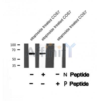 Western blot analysis of MAP2 (Phospho-Thr1616) using etoposide treated COS7 whole cell lysates