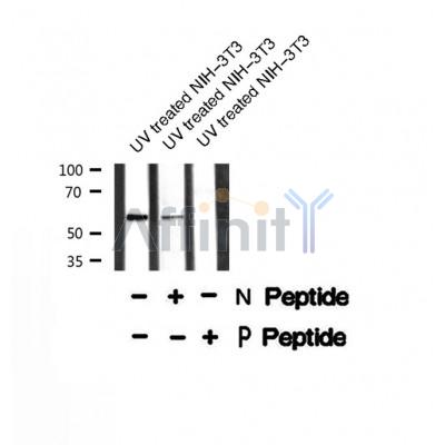 Western blot analysis of TAB1 (Phospho-Ser438) using UV treated NIH-3T3 whole cell lysates