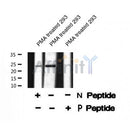 Western blot analysis of TPPP (Phospho-Ser18) using PMA treated 293 whole cell lysates