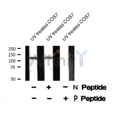 Western blot analysis USP28 (Phospho-Ser714) using UV treated COS7 whole cell lysates