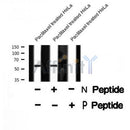 Western blot analysis of ABI1 (Phospho-Tyr212) using Paclitaxel treated HeLa whole cell lysates