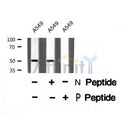 AF8372 staining HeLa cells by IF/ICC. The sample were fixed with PFA and permeabilized in 0.1% Triton X-100,then blocked in 10% serum for 45 minutes at 25¡ãC. The primary antibody was diluted at 1/200 and incubated with the sample for 1 hour at 37¡ãC. An  Alexa Fluor 594 conjugated goat anti-rabbit IgG (H+L) antibody(Cat.