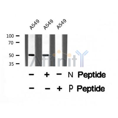 AF8372 staining HeLa cells by IF/ICC. The sample were fixed with PFA and permeabilized in 0.1% Triton X-100,then blocked in 10% serum for 45 minutes at 25¡ãC. The primary antibody was diluted at 1/200 and incubated with the sample for 1 hour at 37¡ãC. An  Alexa Fluor 594 conjugated goat anti-rabbit IgG (H+L) antibody(Cat.