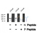 AF8418 staining 293 by IF/ICC. The sample were fixed with PFA and permeabilized in 0.1% Triton X-100,then blocked in 10% serum for 45 minutes at 25¡ãC. The primary antibody was diluted at 1/200 and incubated with the sample for 1 hour at 37¡ãC. An  Alexa Fluor 594 conjugated goat anti-rabbit IgG (H+L) Ab, diluted at 1/600, was used as the secondary antibod