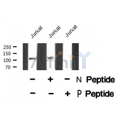 AF8418 staining 293 by IF/ICC. The sample were fixed with PFA and permeabilized in 0.1% Triton X-100,then blocked in 10% serum for 45 minutes at 25¡ãC. The primary antibody was diluted at 1/200 and incubated with the sample for 1 hour at 37¡ãC. An  Alexa Fluor 594 conjugated goat anti-rabbit IgG (H+L) Ab, diluted at 1/600, was used as the secondary antibod