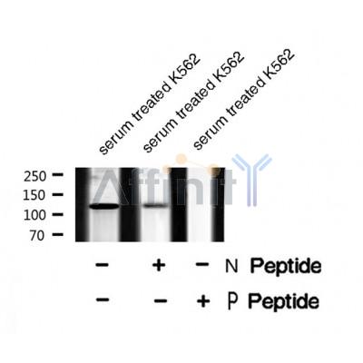 AF8430 staining HepG2 by IF/ICC. The sample were fixed with PFA and permeabilized in 0.1% Triton X-100,then blocked in 10% serum for 45 minutes at 25¡ãC. The primary antibody was diluted at 1/200 and incubated with the sample for 1 hour at 37¡ãC. An  Alexa Fluor 594 conjugated goat anti-rabbit IgG (H+L) Ab, diluted at 1/600, was used as the secondary antibod