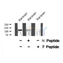 Western blot analysis of EPHB6 (Phospho-Tyr636) using ATP1 Rat brain tissue lysates