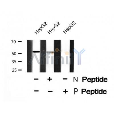 Western blot analysis Smad1/9 (Phospho-Ser463/Ser465) using HepG2 whole cell lysates