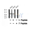 Western blot analysis of EIF6 (Phospho-Ser235) using HeLa whole cell lysates