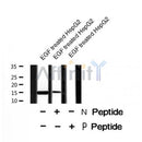 AF8482 staining Hela by IF/ICC. The sample were fixed with PFA and permeabilized in 0.1% Triton X-100,then blocked in 10% serum for 45 minutes at 25¡ãC. The primary antibody was diluted at 1/200 and incubated with the sample for 1 hour at 37¡ãC. An  Alexa Fluor 594 conjugated goat anti-rabbit IgG (H+L) Ab, diluted at 1/600, was used as the secondary antibod