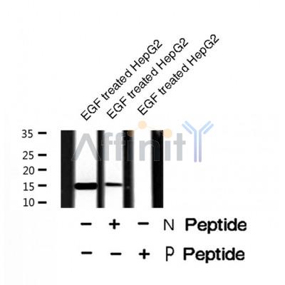 AF8482 staining Hela by IF/ICC. The sample were fixed with PFA and permeabilized in 0.1% Triton X-100,then blocked in 10% serum for 45 minutes at 25¡ãC. The primary antibody was diluted at 1/200 and incubated with the sample for 1 hour at 37¡ãC. An  Alexa Fluor 594 conjugated goat anti-rabbit IgG (H+L) Ab, diluted at 1/600, was used as the secondary antibod