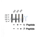 Western blot analysis of HSP105 (Phospho-Ser809) using 293 whole cell lysates