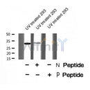 AF8498 staining Hela by IF/ICC. The sample were fixed with PFA and permeabilized in 0.1% Triton X-100,then blocked in 10% serum for 45 minutes at 25¡ãC. The primary antibody was diluted at 1/200 and incubated with the sample for 1 hour at 37¡ãC. An  Alexa Fluor 594 conjugated goat anti-rabbit IgG (H+L) Ab, diluted at 1/600, was used as the secondary antibod