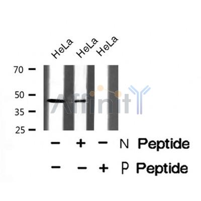 Western blot analysis of PDHA1/2 (Phospho-Ser293/291) using HeLa whole cell lysates