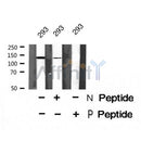 Western blot analysis of extracts from Hela, using TOP2A (Phospho-Ser1337) Antibody. Lane 1 was treated with the blocking peptide.