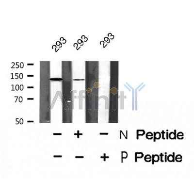 Western blot analysis of extracts from Hela, using TOP2A (Phospho-Ser1337) Antibody. Lane 1 was treated with the blocking peptide.