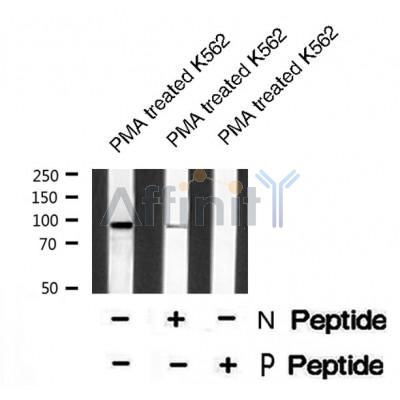 AF8522 staining HuvEc by IF/ICC. The sample were fixed with PFA and permeabilized in 0.1% Triton X-100,then blocked in 10% serum for 45 minutes at 25¡ãC. The primary antibody was diluted at 1/200 and incubated with the sample for 1 hour at 37¡ãC. An  Alexa Fluor 594 conjugated goat anti-rabbit IgG (H+L) Ab, diluted at 1/600, was used as the secondary antibod