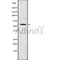 Western blot analysis of Cytochrome P450 4F3 using COLO205 whole cell lysates