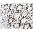 AF3095 staining HeLa by IF/ICC. The sample were fixed with PFA and permeabilized in 0.1% Triton X-100,then blocked in 10% serum for 45 minutes at 25¡ãC. The primary antibody was diluted at 1/200 and incubated with the sample for 1 hour at 37¡ãC. An  Alexa Fluor 594 conjugated goat anti-rabbit IgG (H+L) Ab, diluted at 1/600, was used as the secondary antibod