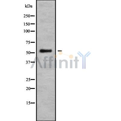 DF9545 at 1/100 staining Human brain cancer tissue by IHC-P. The sample was formaldehyde fixed and a heat mediated antigen retrieval step in citrate buffer was performed. The sample was then blocked and incubated with the antibody for 1.5 hours at 22¡ãC. An HRP conjugated goat anti-rabbit antibody was used as the secondary