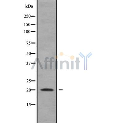 Western blot analysis of extracts from various samples, using IMMP2L Antibody.
 Lane 1: 3t3 treated with blocking peptide;
 Lane 2: 3t3;
 Lane 3: Mouse muscle.