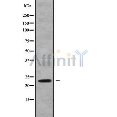 Western blot analysis of extracts from 293, using RAB13 Antibody.