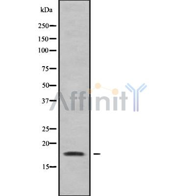 Western blot analysis of extracts from 293, using RARRES3 Antibody.