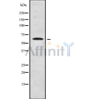 DF9950 at 1/100 staining Rat brain tissue by IHC-P. The sample was formaldehyde fixed and a heat mediated antigen retrieval step in citrate buffer was performed. The sample was then blocked and incubated with the antibody for 1.5 hours at 22¡ãC. An HRP conjugated goat anti-rabbit antibody was used as the secondary