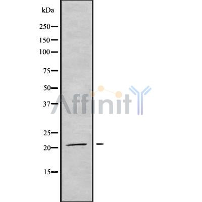 Western blot analysis of extracts from rat brain, using TRAPPC5 Antibody. Lane 1 was treated with the blocking peptide.