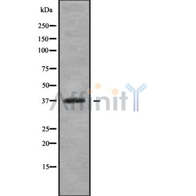 DF9971 at 1/100 staining Mouse liver tissue by IHC-P. The sample was formaldehyde fixed and a heat mediated antigen retrieval step in citrate buffer was performed. The sample was then blocked and incubated with the antibody for 1.5 hours at 22¡ãC. An HRP conjugated goat anti-rabbit antibody was used as the secondary