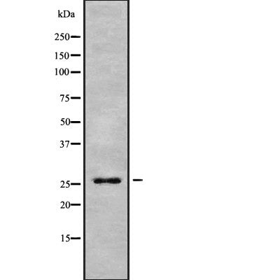 AF9009 staining Hela by IF/ICC. The sample were fixed with PFA and permeabilized in 0.1% Triton X-100,then blocked in 10% serum for 45 minutes at 25¡ãC. The primary antibody was diluted at 1/200 and incubated with the sample for 1 hour at 37¡ãC. An  Alexa Fluor 594 conjugated goat anti-rabbit IgG (H+L) Ab, diluted at 1/600, was used as the secondary antibod