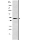 AF9015 staining HuvEc by IF/ICC. The sample were fixed with PFA and permeabilized in 0.1% Triton X-100,then blocked in 10% serum for 45 minutes at 25¡ãC. The primary antibody was diluted at 1/200 and incubated with the sample for 1 hour at 37¡ãC. An  Alexa Fluor 594 conjugated goat anti-rabbit IgG (H+L) Ab, diluted at 1/600, was used as the secondary antibod