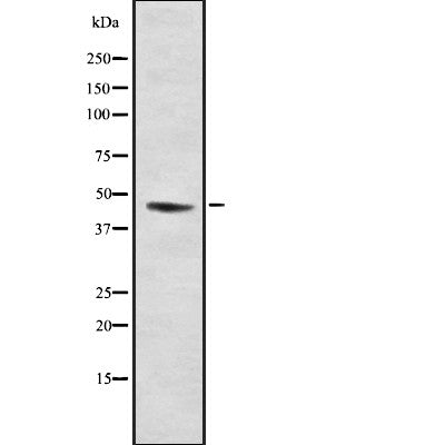 AF9015 staining HuvEc by IF/ICC. The sample were fixed with PFA and permeabilized in 0.1% Triton X-100,then blocked in 10% serum for 45 minutes at 25¡ãC. The primary antibody was diluted at 1/200 and incubated with the sample for 1 hour at 37¡ãC. An  Alexa Fluor 594 conjugated goat anti-rabbit IgG (H+L) Ab, diluted at 1/600, was used as the secondary antibod