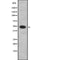 AF9016 staining Hela by IF/ICC. The sample were fixed with PFA and permeabilized in 0.1% Triton X-100,then blocked in 10% serum for 45 minutes at 25¡ãC. The primary antibody was diluted at 1/200 and incubated with the sample for 1 hour at 37¡ãC. An  Alexa Fluor 594 conjugated goat anti-rabbit IgG (H+L) Ab, diluted at 1/600, was used as the secondary antibod