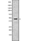 AF9018 staining COLO205 by IF/ICC. The sample were fixed with PFA and permeabilized in 0.1% Triton X-100,then blocked in 10% serum for 45 minutes at 25¡ãC. The primary antibody was diluted at 1/200 and incubated with the sample for 1 hour at 37¡ãC. An  Alexa Fluor 594 conjugated goat anti-rabbit IgG (H+L) Ab, diluted at 1/600, was used as the secondary antibod